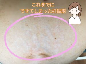 妊娠線　ホホバオイル　アーモンドオイル